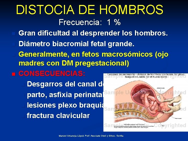 DISTOCIA DE HOMBROS Frecuencia: 1 % n n Gran dificultad al desprender los hombros.