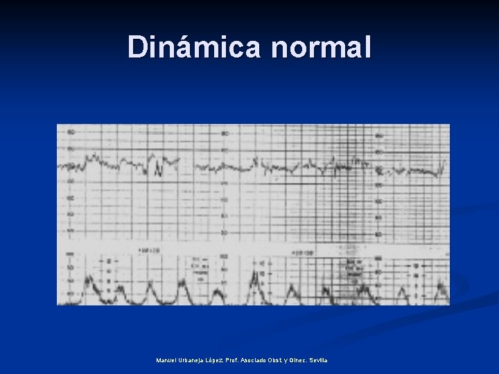 Dinámica normal Manuel Urbaneja López. Prof. Asociado Obst. y Ginec. Sevilla 