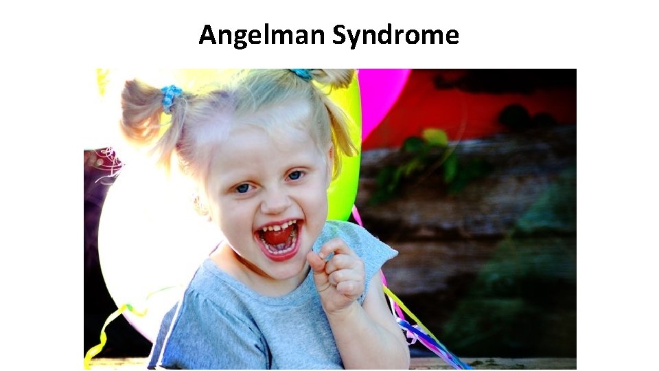Angelman Syndrome 