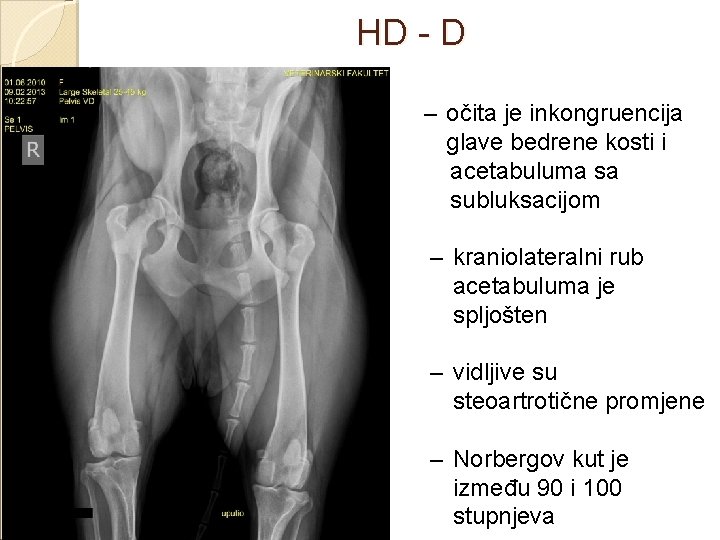 HD - D – očita je inkongruencija glave bedrene kosti i acetabuluma sa subluksacijom