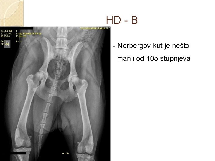 HD - B - Norbergov kut je nešto manji od 105 stupnjeva 