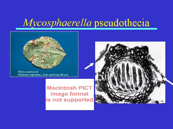 Mycosphaerella pseudothecia 