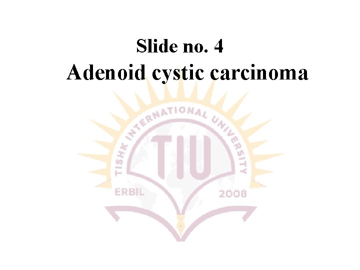 Slide no. 4 Adenoid cystic carcinoma 