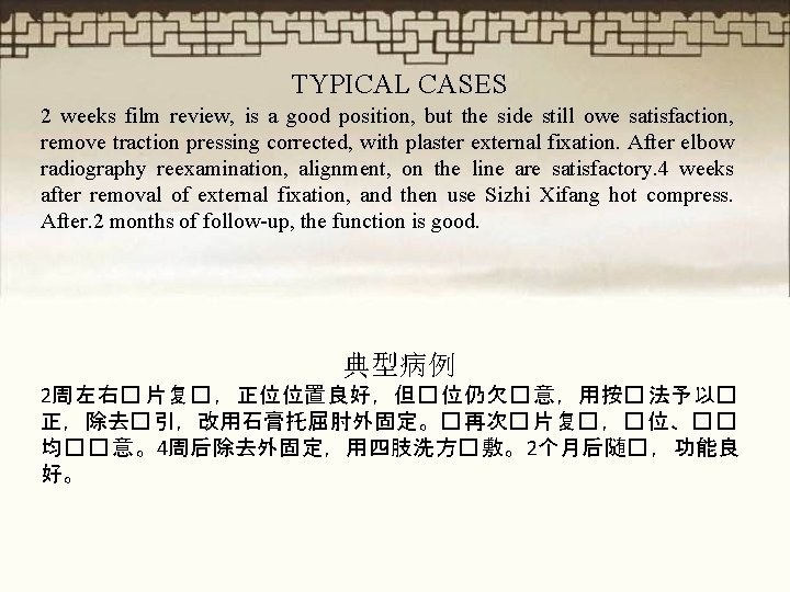 TYPICAL CASES 2 weeks film review, is a good position, but the side still