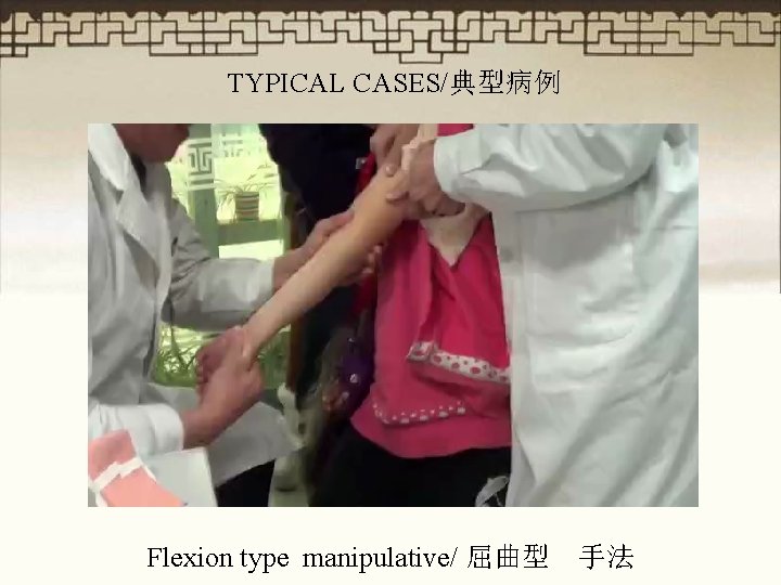 TYPICAL CASES/典型病例 Flexion type manipulative/ 屈曲型 手法 