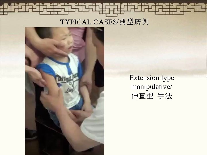 TYPICAL CASES/典型病例 Extension type manipulative/ 伸直型 手法 