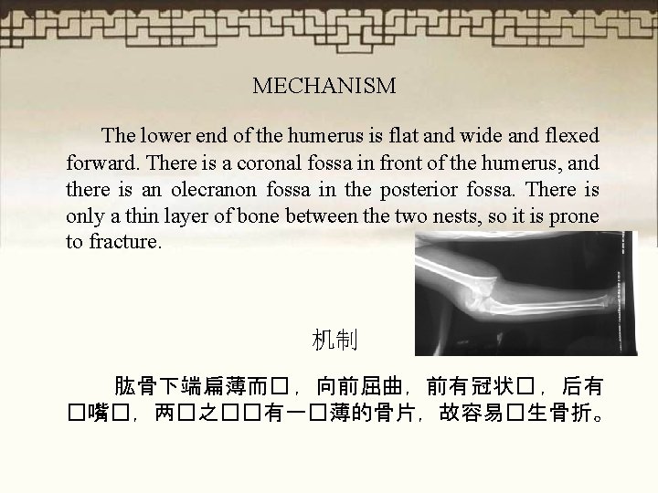 MECHANISM The lower end of the humerus is flat and wide and flexed forward.