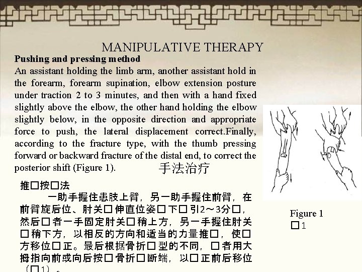 MANIPULATIVE THERAPY Pushing and pressing method An assistant holding the limb arm, another assistant