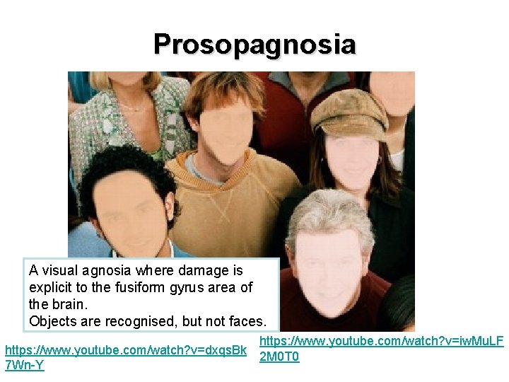 Prosopagnosia A visual agnosia where damage is explicit to the fusiform gyrus area of