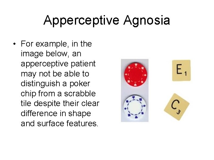 Apperceptive Agnosia • For example, in the image below, an apperceptive patient may not