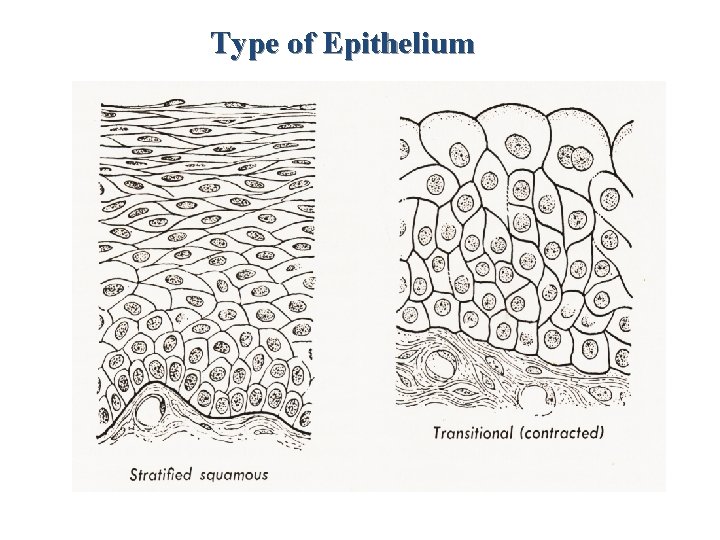 Type of Epithelium 