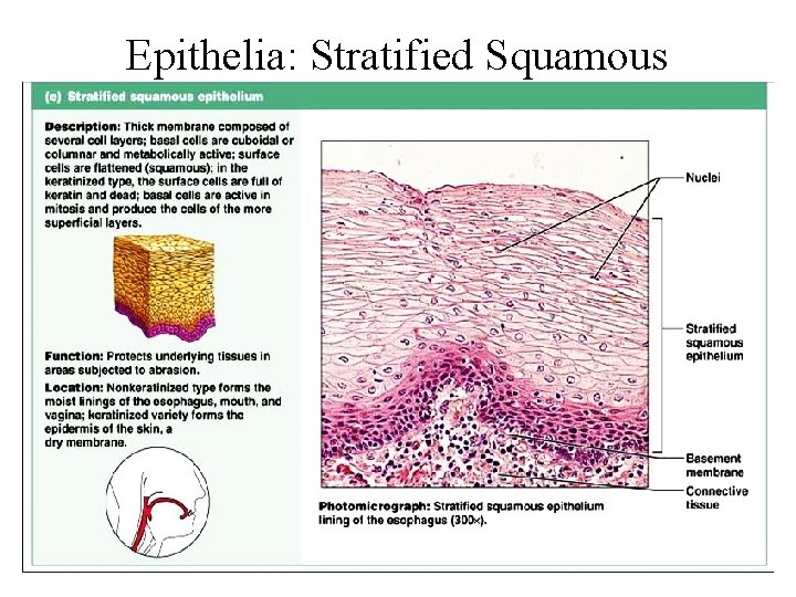 Epithelia: Stratified Squamous Figure 4. 2 e 