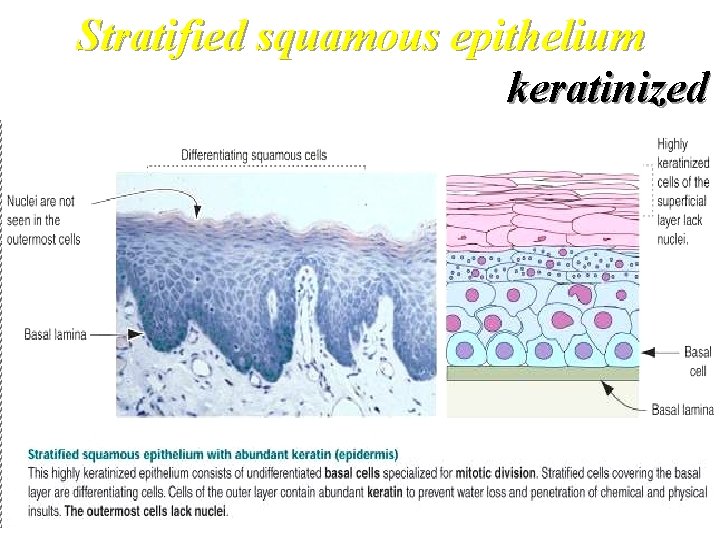 Stratified squamous epithelium keratinized 