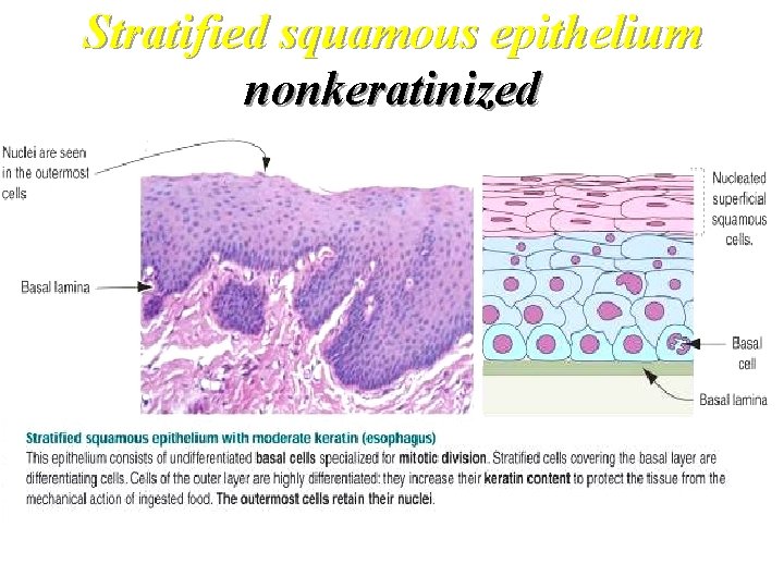 Stratified squamous epithelium nonkeratinized 