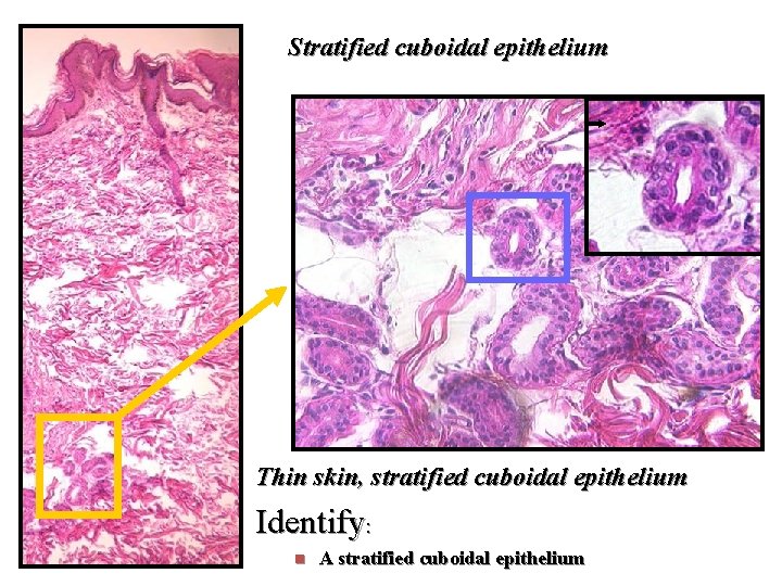 Stratified cuboidal epithelium Thin skin, stratified cuboidal epithelium Identify: n A stratified cuboidal epithelium