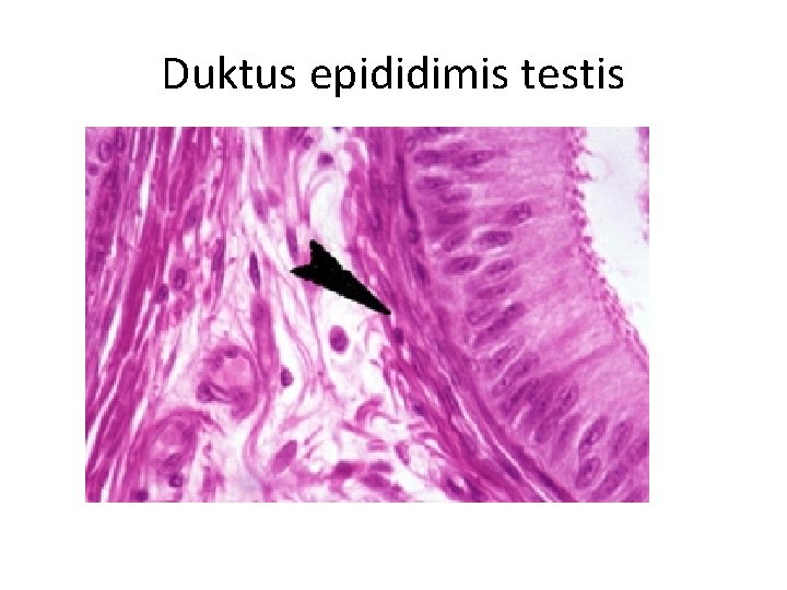 Duktus epididimis testis 