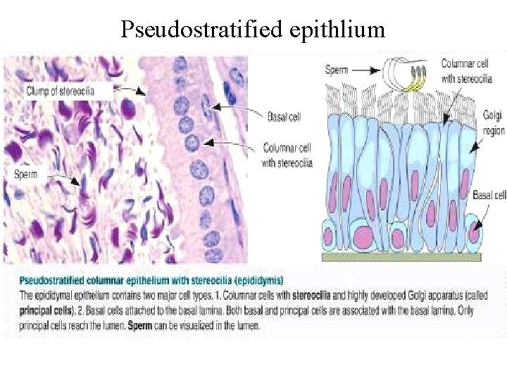 Pseudostratified epithlium 