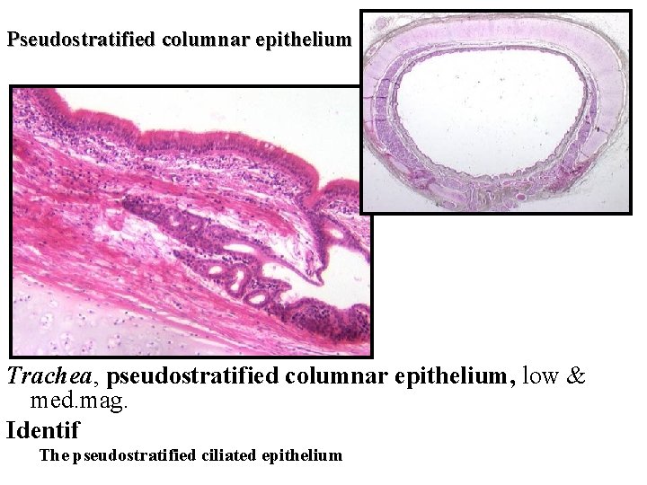 Pseudostratified columnar epithelium Trachea, pseudostratified columnar epithelium, low & med. mag. Identif The pseudostratified