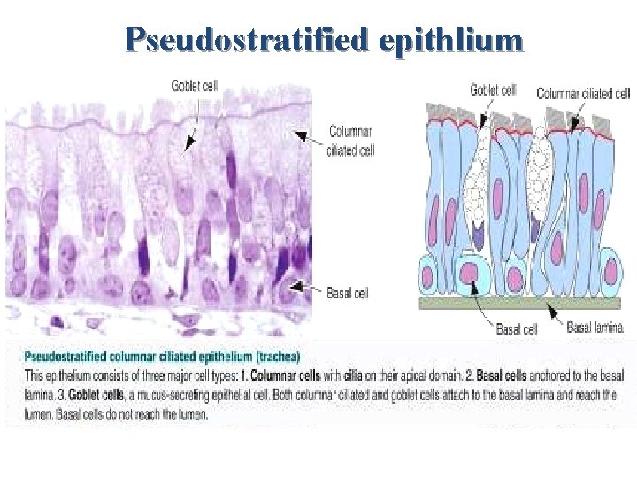 Pseudostratified epithlium 