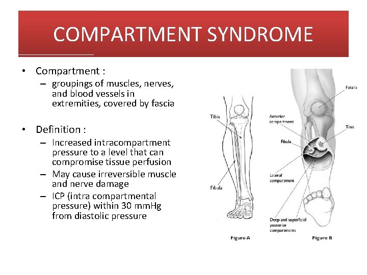 COMPARTMENT SYNDROME • Compartment : – groupings of muscles, nerves, and blood vessels in