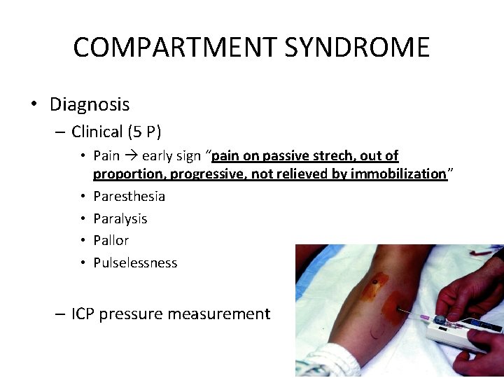 COMPARTMENT SYNDROME • Diagnosis – Clinical (5 P) • Pain early sign “pain on