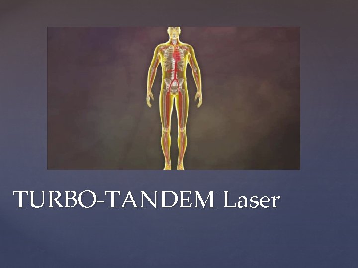 TURBO-TANDEM Laser 