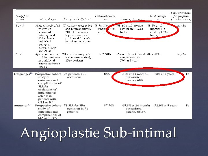 Angioplastie Sub-intimal 