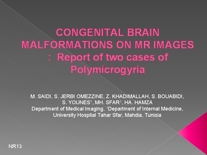 CONGENITAL BRAIN MALFORMATIONS ON MR IMAGES : Report of two cases of Polymicrogyria M.