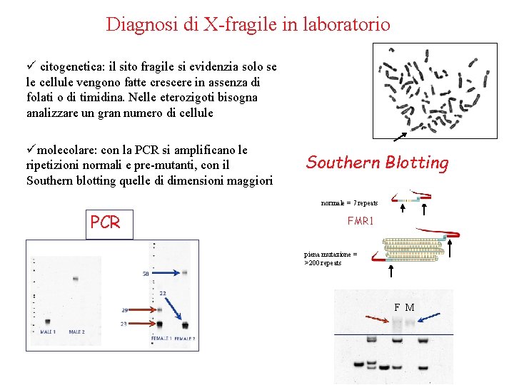 Diagnosi di X-fragile in laboratorio ü citogenetica: il sito fragile si evidenzia solo se