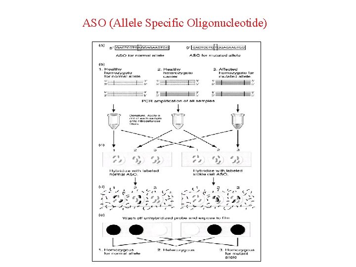ASO (Allele Specific Oligonucleotide) 