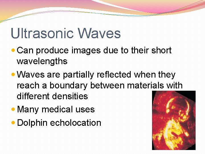 Ultrasonic Waves Can produce images due to their short wavelengths Waves are partially reflected