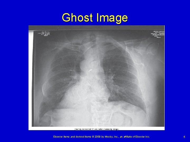 Ghost Image Elsevier items and derived items © 2009 by Mosby, Inc. , an
