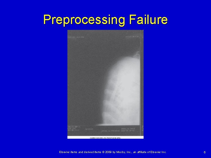 Preprocessing Failure Elsevier items and derived items © 2009 by Mosby, Inc. , an