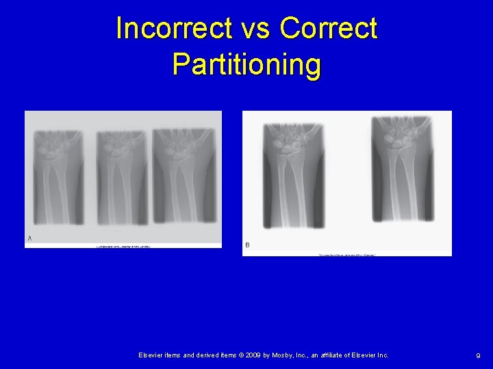 Incorrect vs Correct Partitioning Elsevier items and derived items © 2009 by Mosby, Inc.