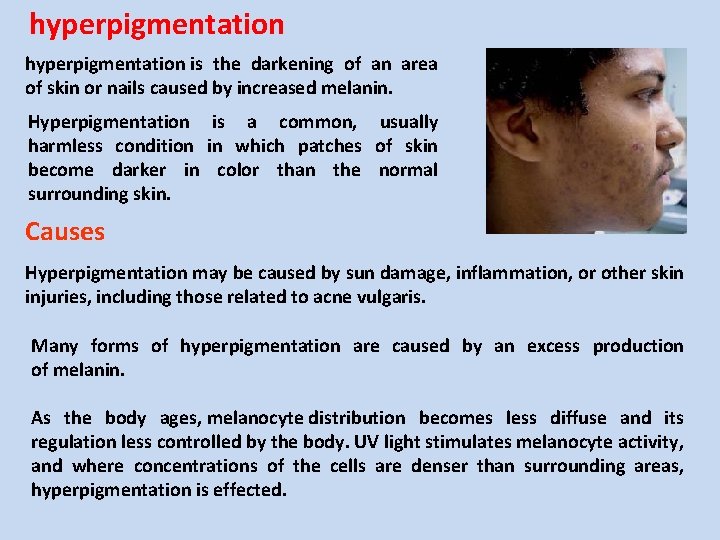 hyperpigmentation is the darkening of an area of skin or nails caused by increased