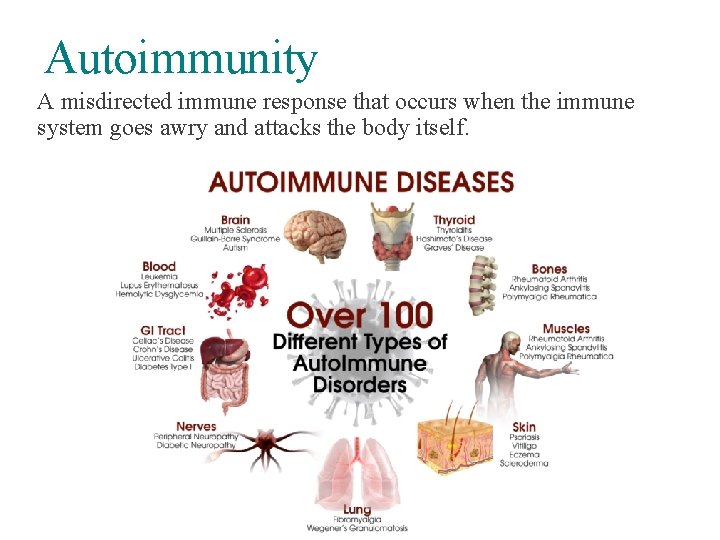 Autoimmunity A misdirected immune response that occurs when the immune system goes awry and