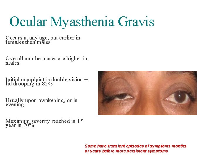 Ocular Myasthenia Gravis Occurs at any age, but earlier in females than males Overall