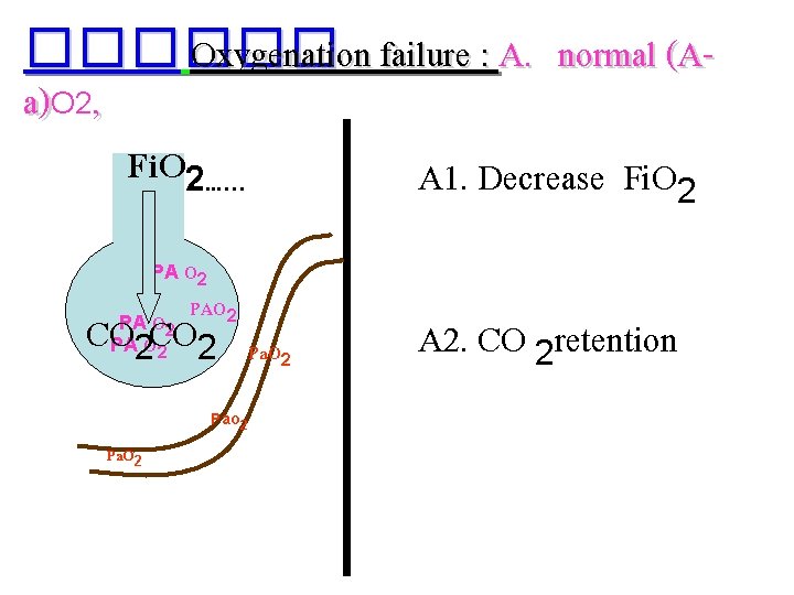 ������ Oxygenation failure : A. normal (Aa)O 2, Fi. O 2. . . …