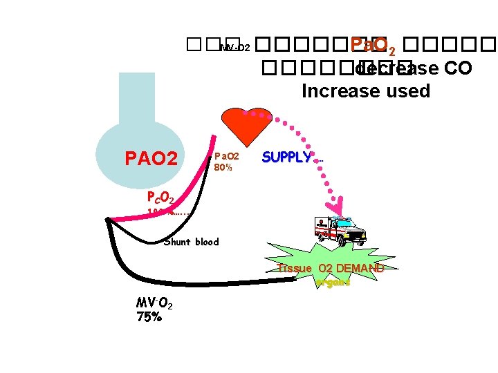 ��� MV-O 2 ������� Pa. O 2 �������� decrease CO Increase used PAO 2