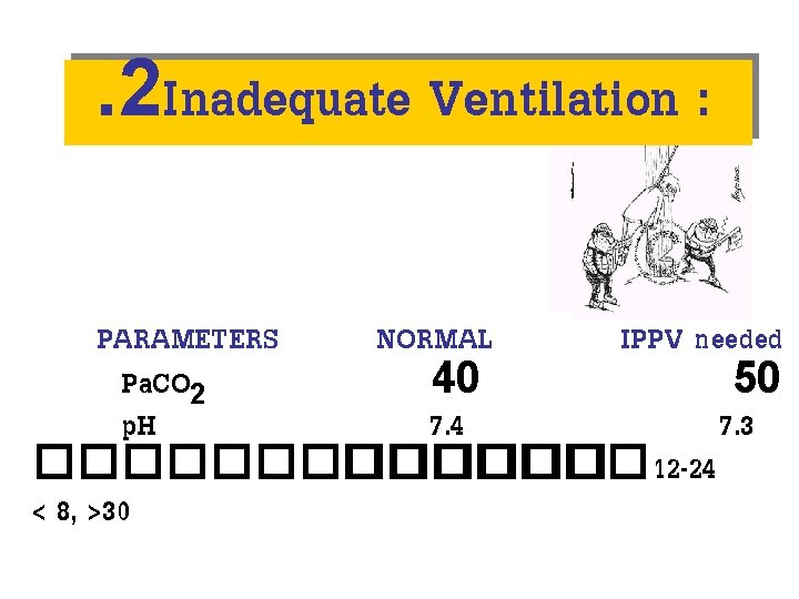 . 2 Inadequate Ventilation : PARAMETERS NORMAL IPPV needed Pa. CO 2 40 50