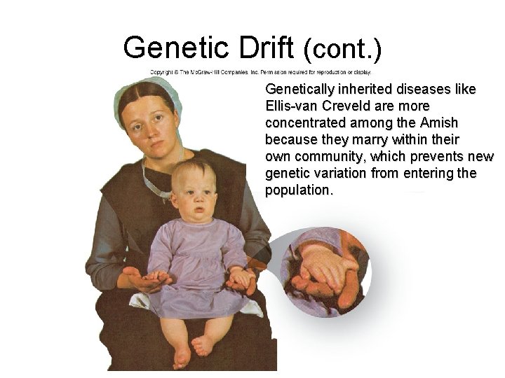 Genetic Drift (cont. ) Genetically inherited diseases like Ellis-van Creveld are more concentrated among