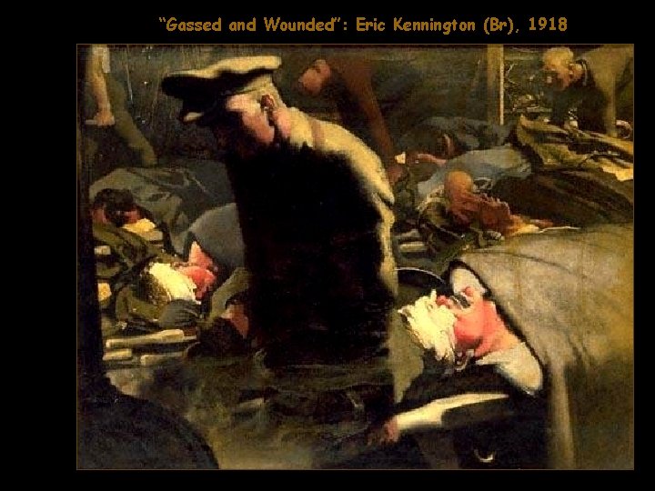 “Gassed and Wounded”: Eric Kennington (Br), 1918 