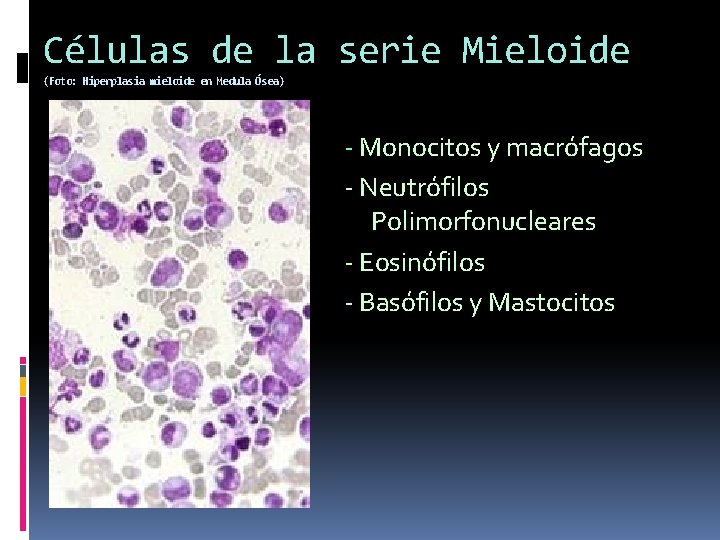 Células de la serie Mieloide (Foto: Hiperplasia mieloide en Medula Ósea) - Monocitos y