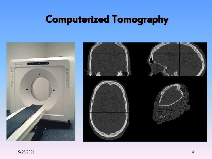 Computerized Tomography 5/25/2021 4 