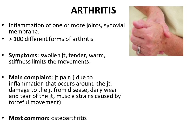 ARTHRITIS • Inflammation of one or more joints, synovial membrane. • > 100 different