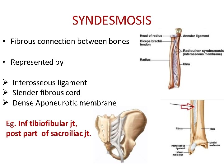 SYNDESMOSIS • Fibrous connection between bones • Represented by Interosseous ligament Slender fibrous cord