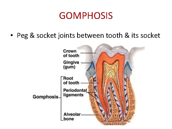 GOMPHOSIS • Peg & socket joints between tooth & its socket 
