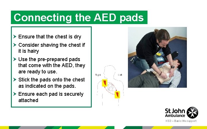 Connecting the AED pads Ensure that the chest is dry Consider shaving the chest