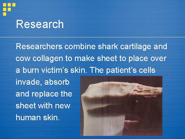 Researchers combine shark cartilage and cow collagen to make sheet to place over a