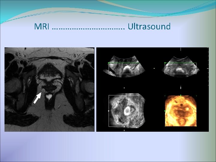 MRI …………………. . Ultrasound 